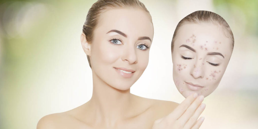 Macchie del viso: i migliori trattamenti di medicina estetica